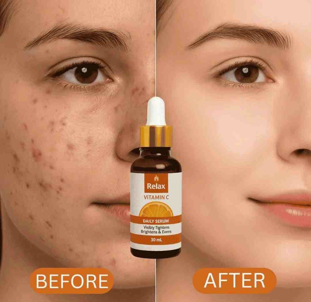 Relax Vitamin C Daily Serum Brightening & Anti-Aging Face Serum - 30ml